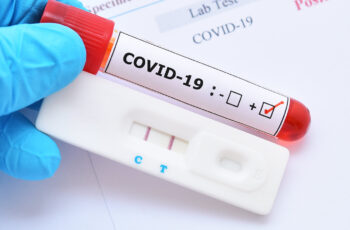 COVID-19 Antibody Testing