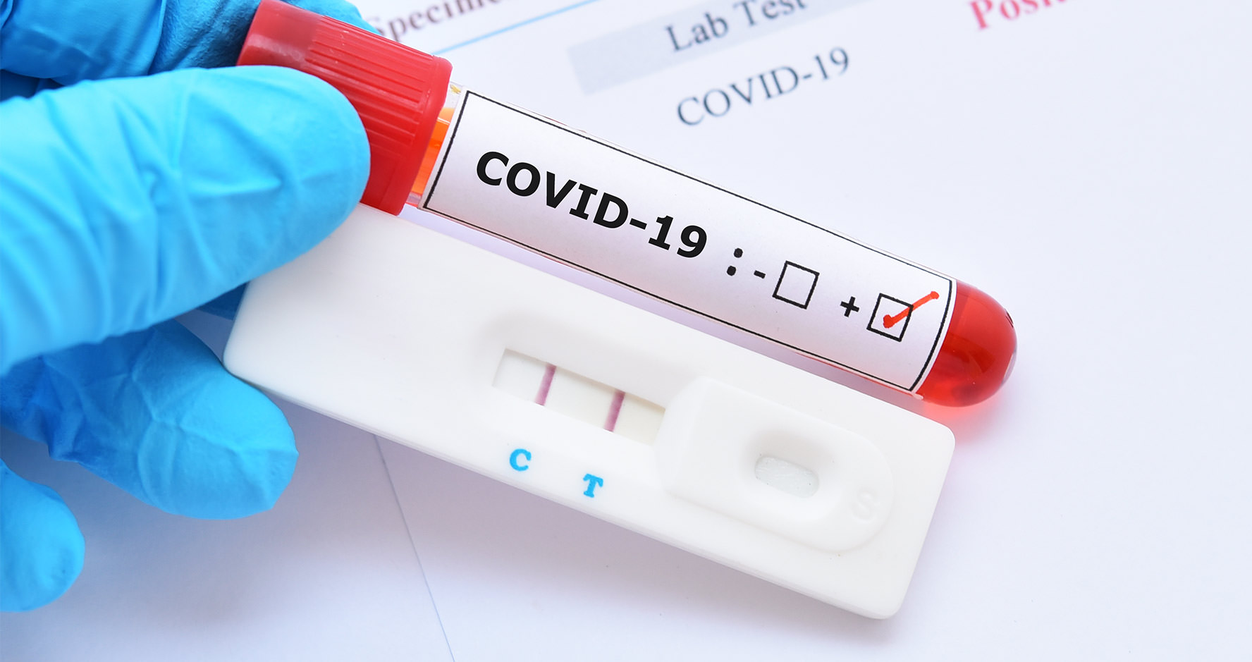 COVID19 Antibody Testing MyDoc Urgent Care