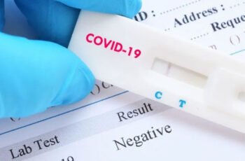 Rapid COVID-19 Tests